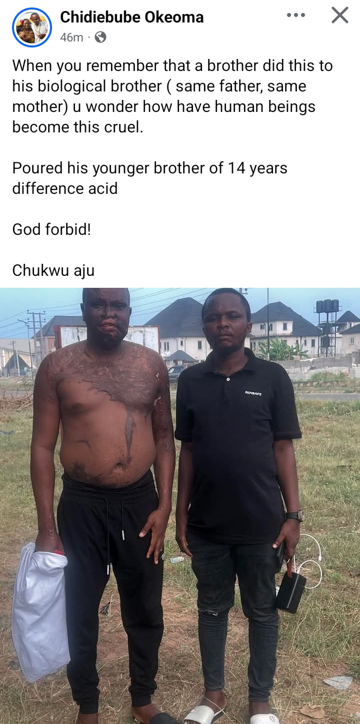1778684843 732 Nigerian man pours acid on his elder brother
