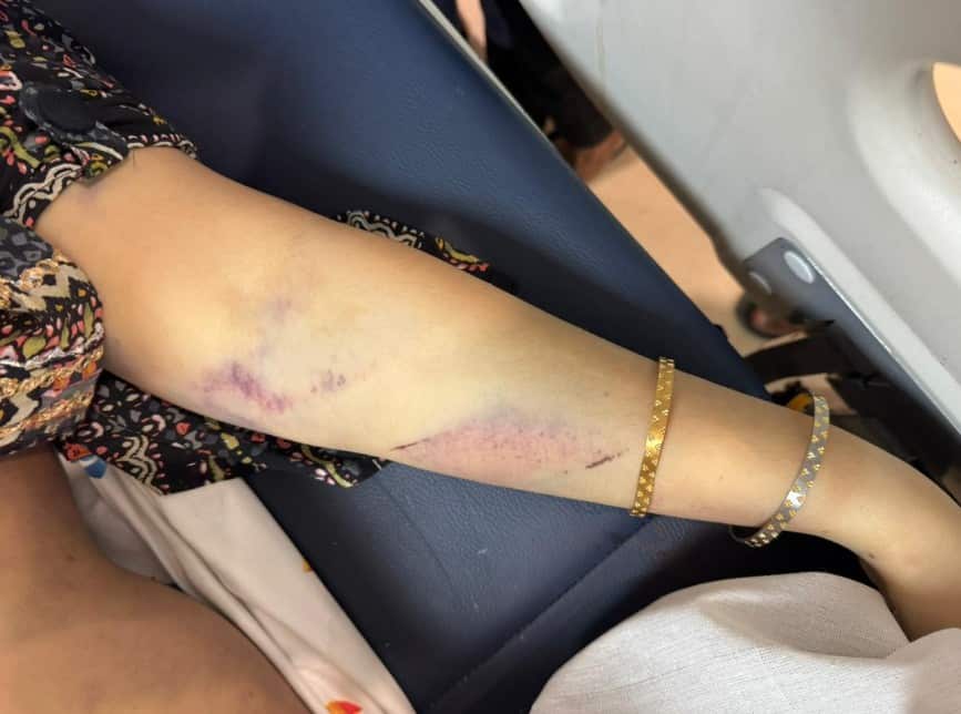 Newly married beauty queen falls to her d